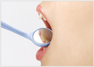 口の中の粘膜の病気チェック